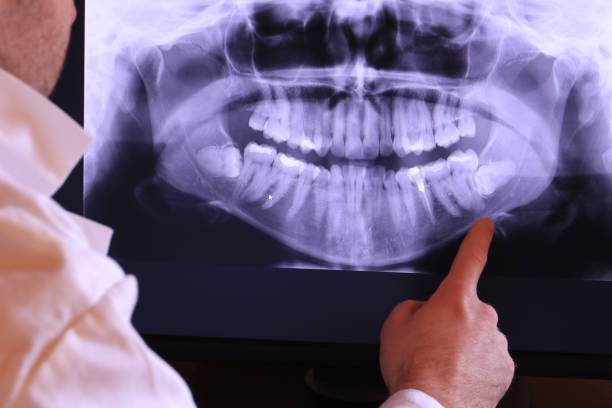 Best Broken or Chipped Tooth Repair in Arlington, VA